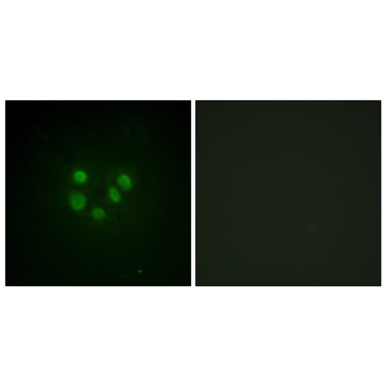 Immunofluorescence - Anti-Bloom Syndrome Antibody (B0778) - Antibodies.com
