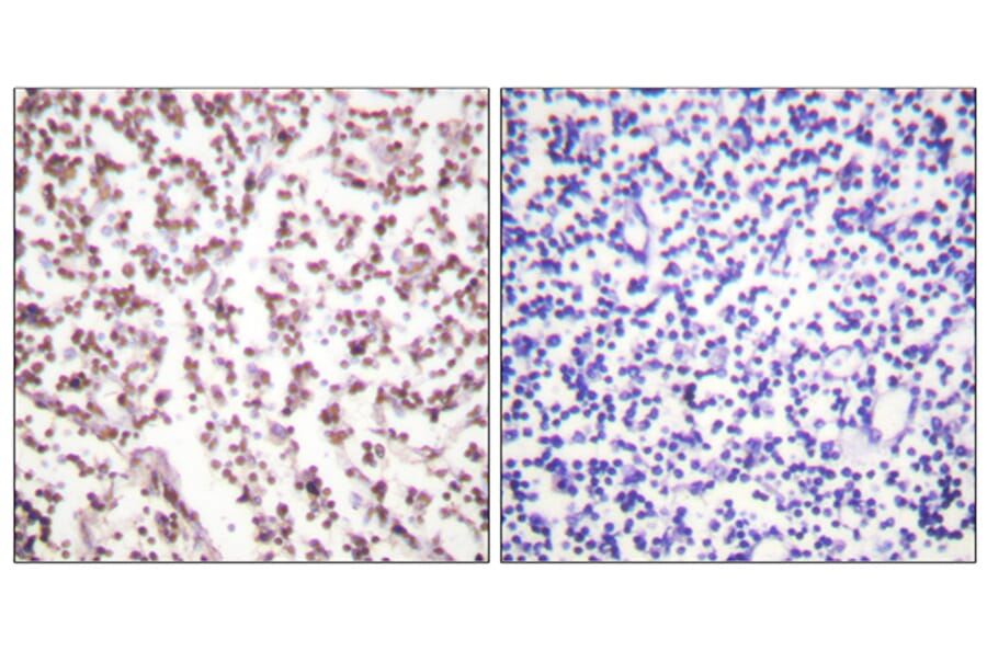 Immunohistochemistry - Anti-Bloom Syndrome Antibody (B0778) - Antibodies.com