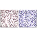 Immunohistochemistry - Anti-Bloom Syndrome Antibody (B0778) - Antibodies.com