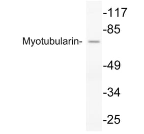 Western Blot - Anti-Myotubularin Antibody (R12-2247) - Antibodies.com