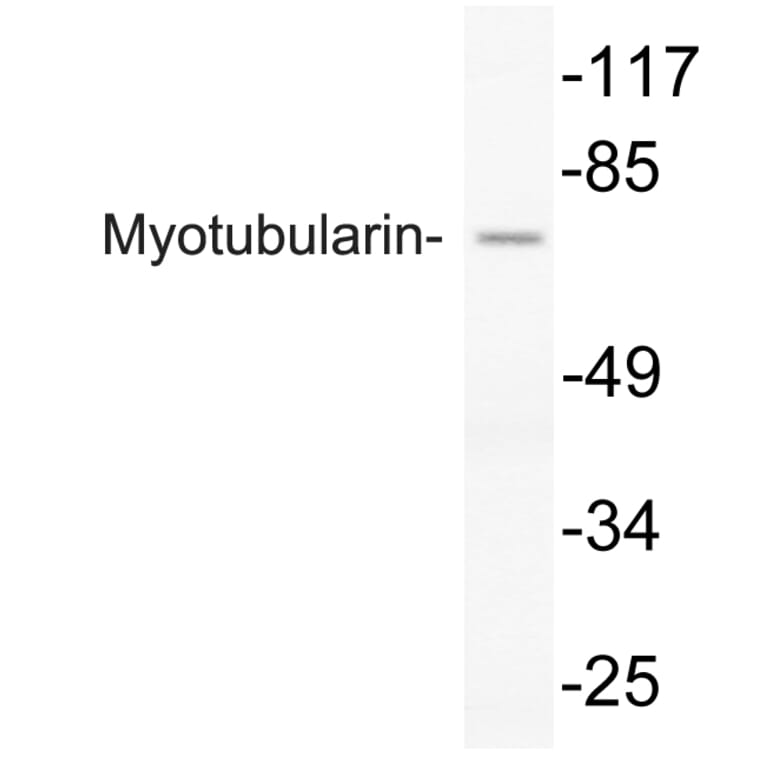 Western Blot - Anti-Myotubularin Antibody (R12-2247) - Antibodies.com