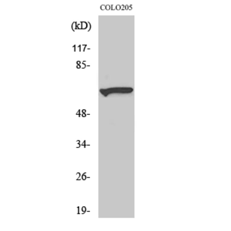Western Blot - Anti-Myotubularin Antibody (R12-2247) - Antibodies.com