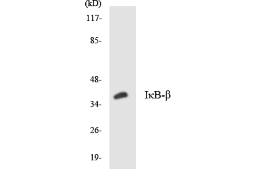 Western Blot - Anti-IkappaB-beta Antibody (R12-2939) - Antibodies.com