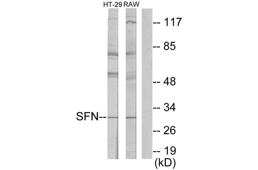 Western Blot - Anti-14-3-3 sigma Antibody (C12005) - Antibodies.com