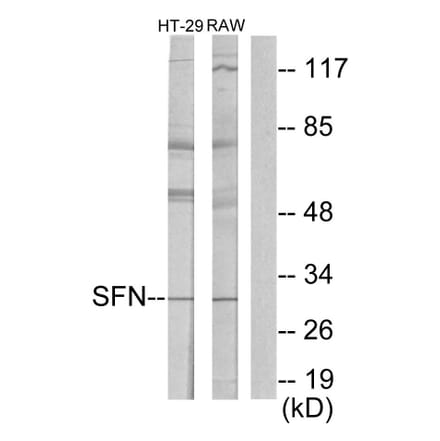 Western Blot - Anti-14-3-3 sigma Antibody (C12005) - Antibodies.com