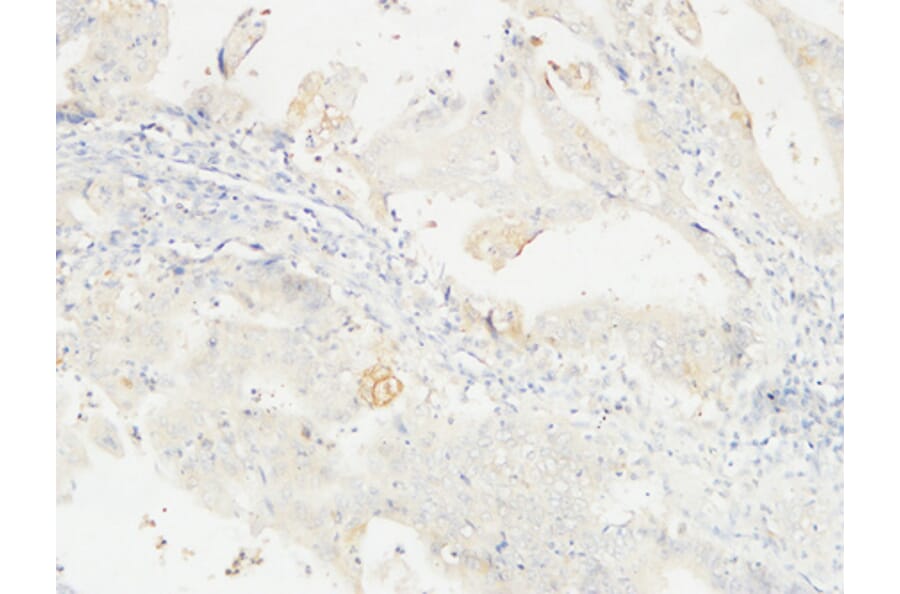 Immunohistochemistry - Anti-14-3-3 sigma Antibody (C12005) - Antibodies.com