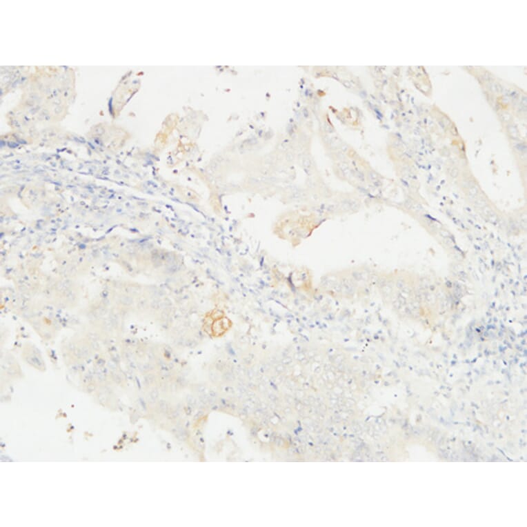 Immunohistochemistry - Anti-14-3-3 sigma Antibody (C12005) - Antibodies.com