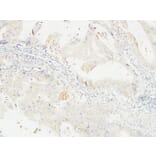 Immunohistochemistry - Anti-14-3-3 sigma Antibody (C12005) - Antibodies.com