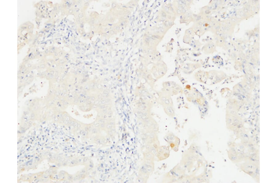 Immunohistochemistry - Anti-14-3-3 sigma Antibody (C12005) - Antibodies.com