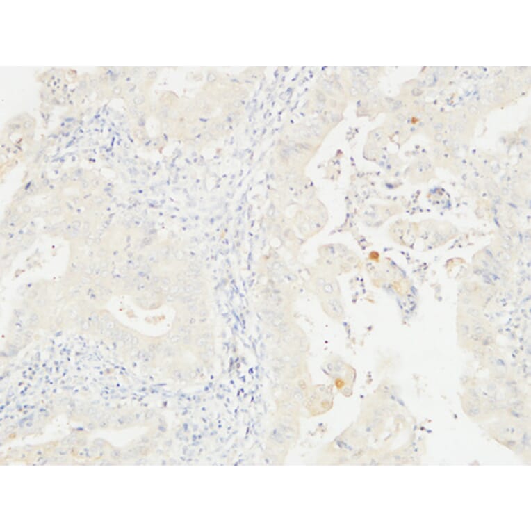 Immunohistochemistry - Anti-14-3-3 sigma Antibody (C12005) - Antibodies.com