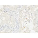 Immunohistochemistry - Anti-14-3-3 sigma Antibody (C12005) - Antibodies.com