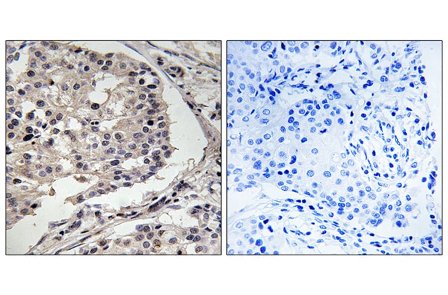 Immunohistochemistry - Anti-MLK1 + MLK2 Antibody (B8142) - Antibodies.com