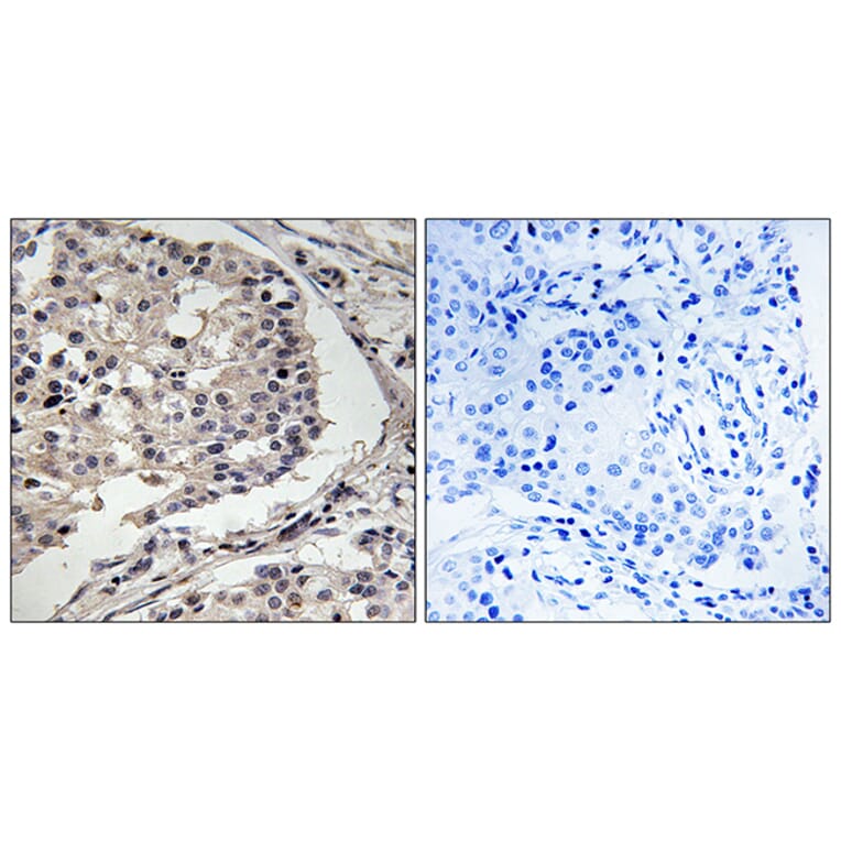 Immunohistochemistry - Anti-MLK1 + MLK2 Antibody (B8142) - Antibodies.com