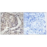 Immunohistochemistry - Anti-MLK1 + MLK2 Antibody (B8142) - Antibodies.com
