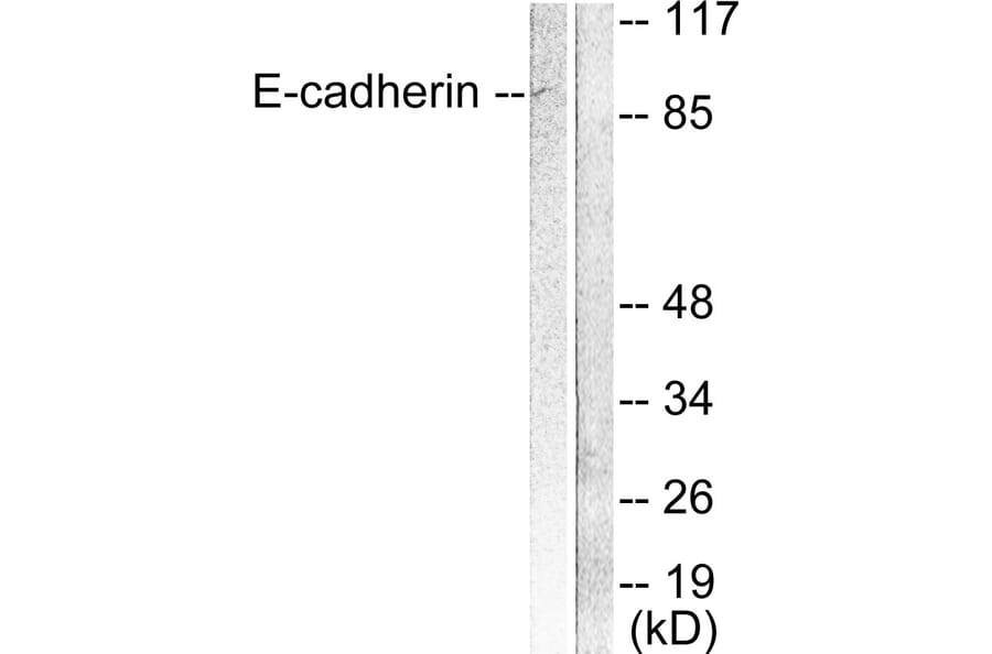 Western Blot - Anti-E-cadherin Antibody (C0147) - Antibodies.com