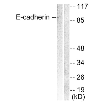 Western Blot - Anti-E-cadherin Antibody (C0147) - Antibodies.com
