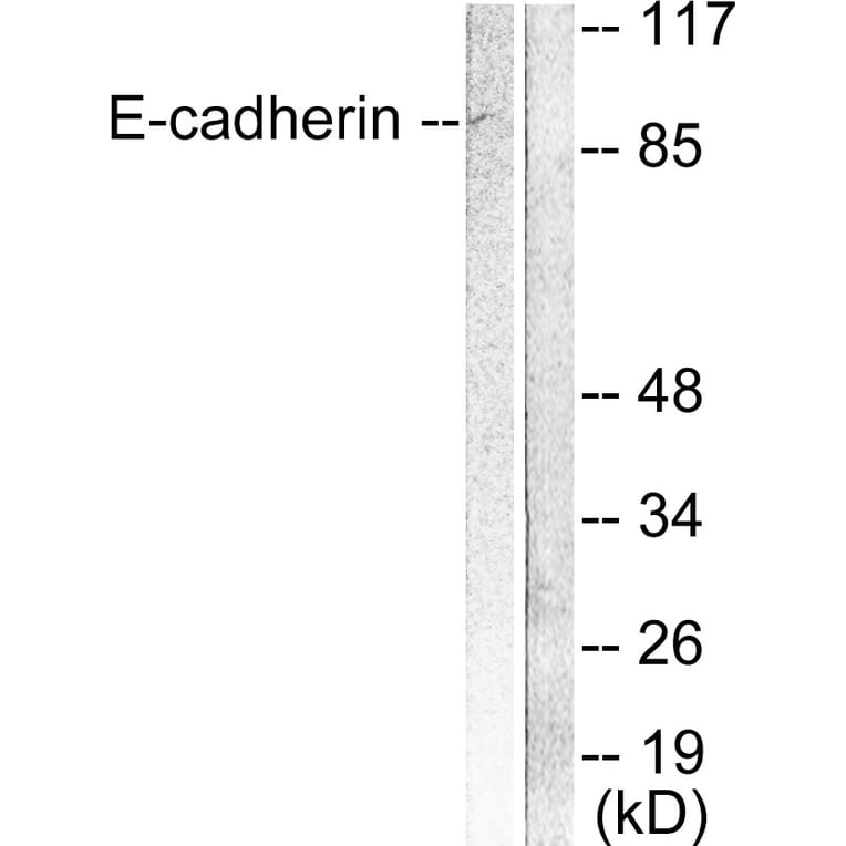 Western Blot - Anti-E-cadherin Antibody (C0147) - Antibodies.com