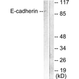 Western Blot - Anti-E-cadherin Antibody (C0147) - Antibodies.com