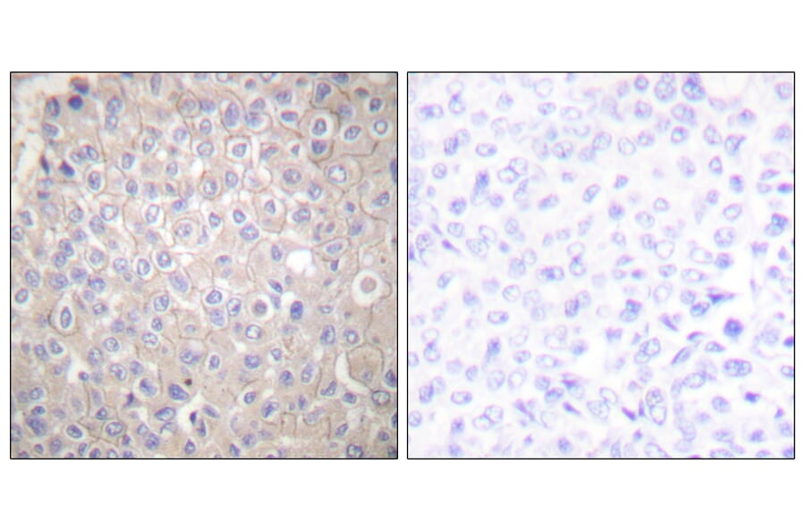 Immunohistochemistry - Anti-E-cadherin Antibody (C0147) - Antibodies.com