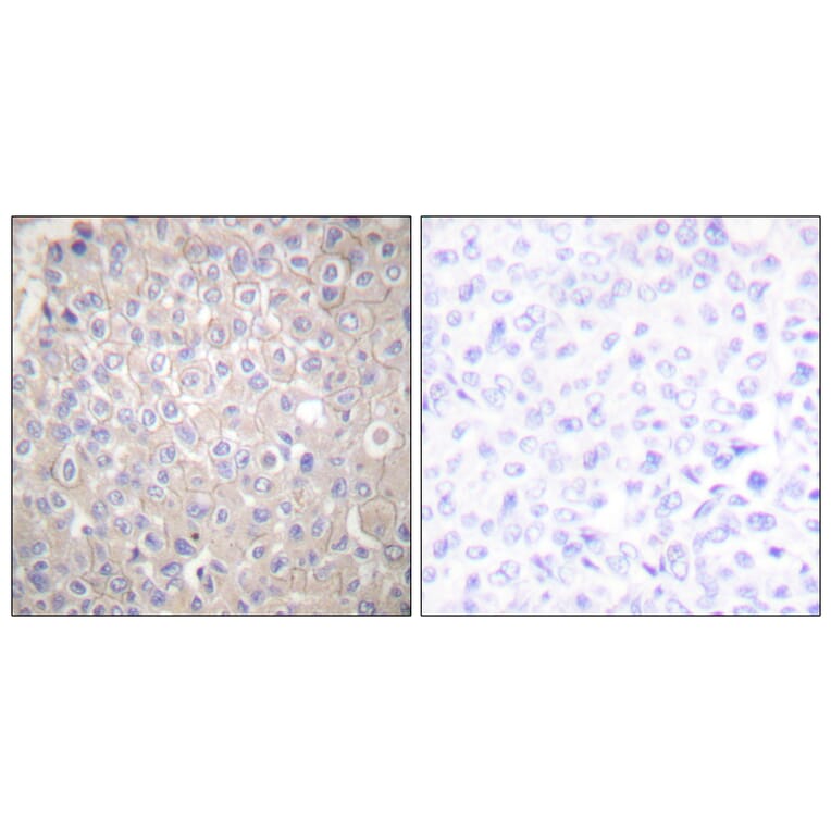 Immunohistochemistry - Anti-E-cadherin Antibody (C0147) - Antibodies.com