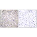 Immunohistochemistry - Anti-E-cadherin Antibody (C0147) - Antibodies.com