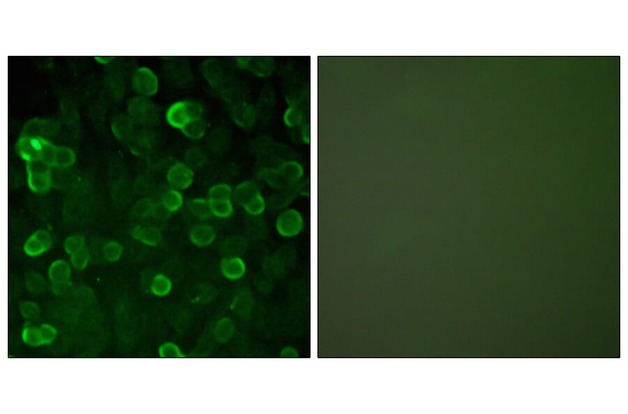 Immunofluorescence - Anti-E-cadherin Antibody (C0147) - Antibodies.com