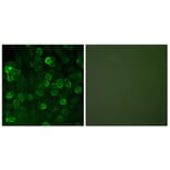 Immunofluorescence - Anti-E-cadherin Antibody (C0147) - Antibodies.com