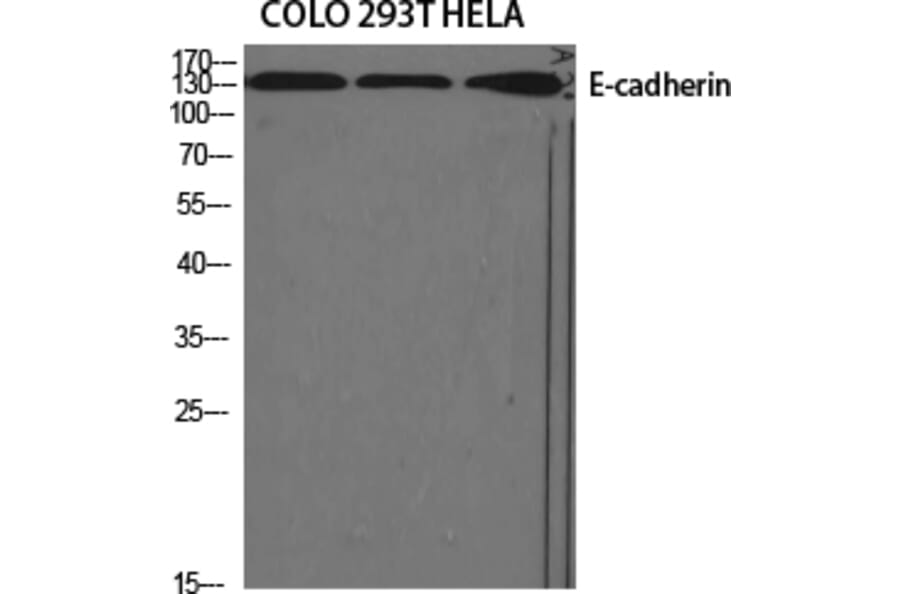 Western Blot - Anti-E-cadherin Antibody (C0147) - Antibodies.com