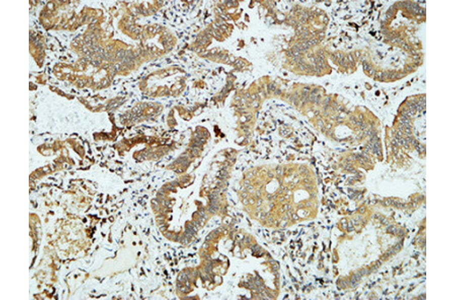 Immunohistochemistry - Anti-E-cadherin Antibody (C0147) - Antibodies.com