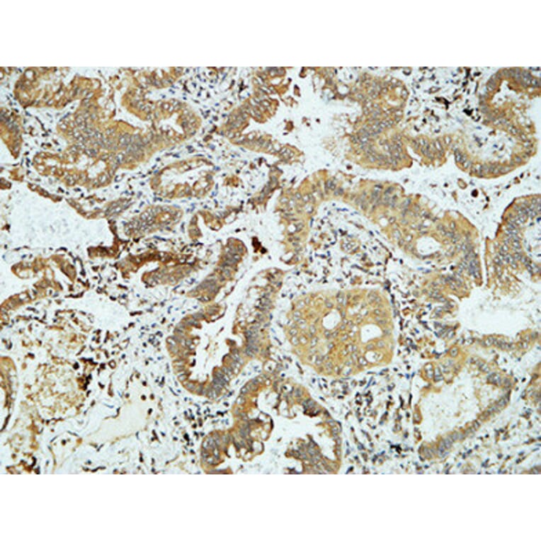 Immunohistochemistry - Anti-E-cadherin Antibody (C0147) - Antibodies.com