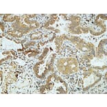 Immunohistochemistry - Anti-E-cadherin Antibody (C0147) - Antibodies.com