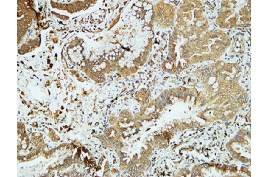 Immunohistochemistry - Anti-E-cadherin Antibody (C0147) - Antibodies.com