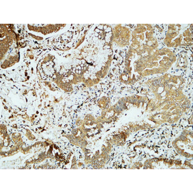 Immunohistochemistry - Anti-E-cadherin Antibody (C0147) - Antibodies.com