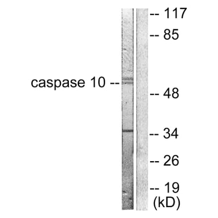 Western Blot - Anti-Caspase 10 Antibody (C0135) - Antibodies.com
