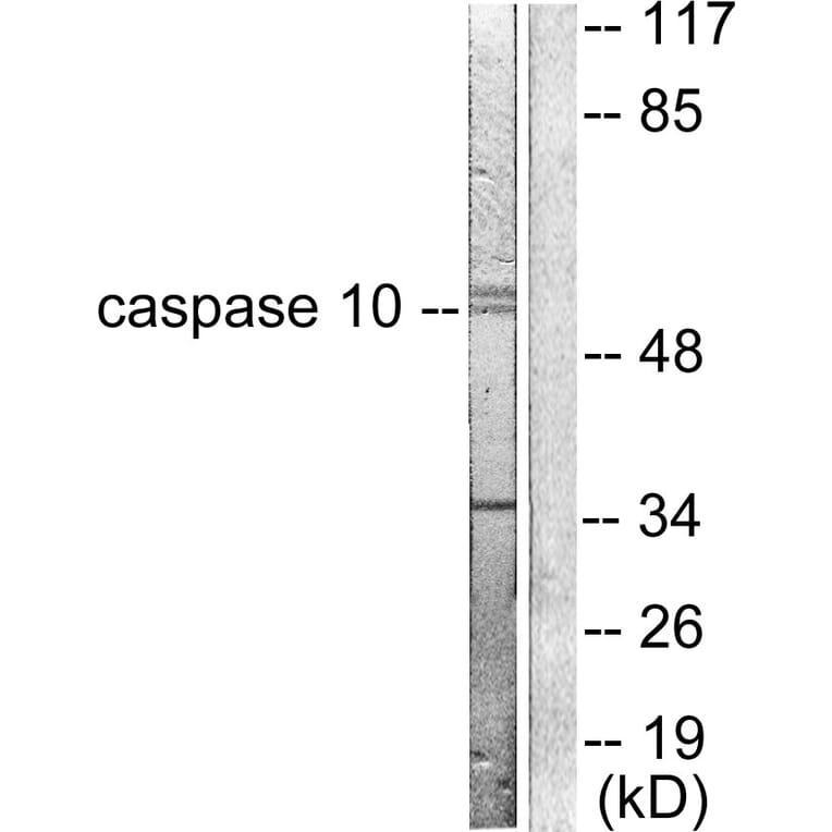Western Blot - Anti-Caspase 10 Antibody (C0135) - Antibodies.com