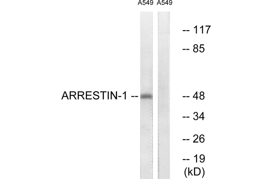 Western Blot - Anti-Arrestin 1 Antibody (B0455) - Antibodies.com
