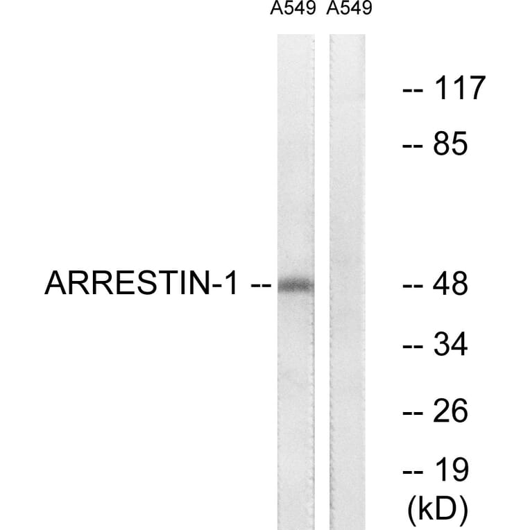Western Blot - Anti-Arrestin 1 Antibody (B0455) - Antibodies.com