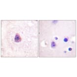 Immunohistochemistry - Anti-Arrestin 1 Antibody (B0455) - Antibodies.com