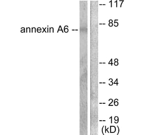 Western Blot - Anti-Annexin A6 Antibody (C0126) - Antibodies.com