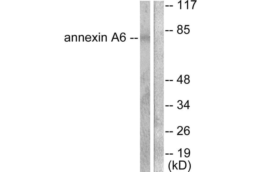 Western Blot - Anti-Annexin A6 Antibody (C0126) - Antibodies.com