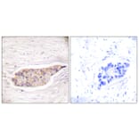 Immunohistochemistry - Anti-Annexin A6 Antibody (C0126) - Antibodies.com