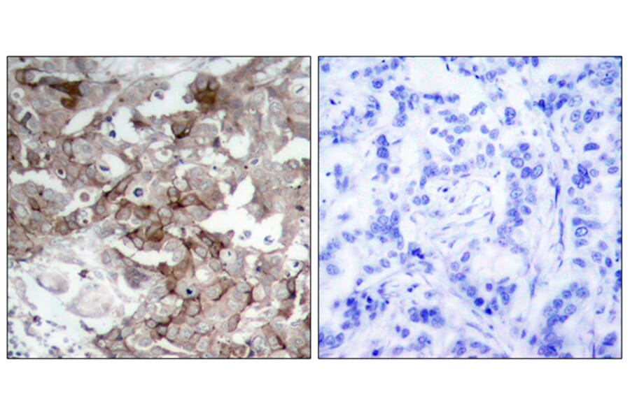 Immunohistochemistry - Anti-Cortactin Antibody (B7050) - Antibodies.com