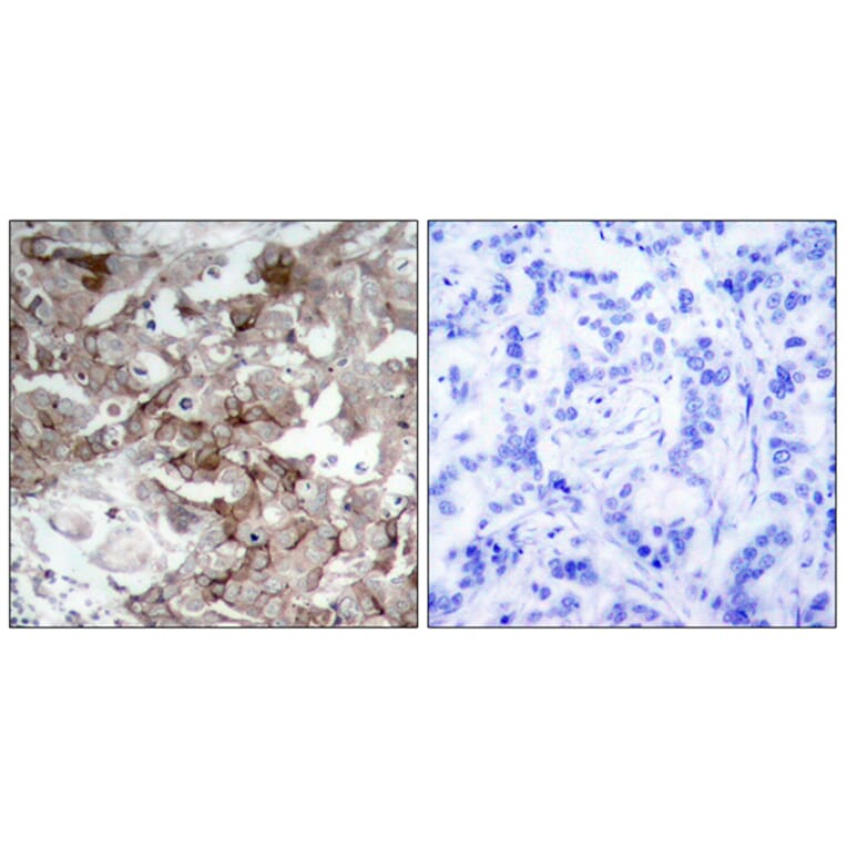 Immunohistochemistry - Anti-Cortactin Antibody (B7050) - Antibodies.com