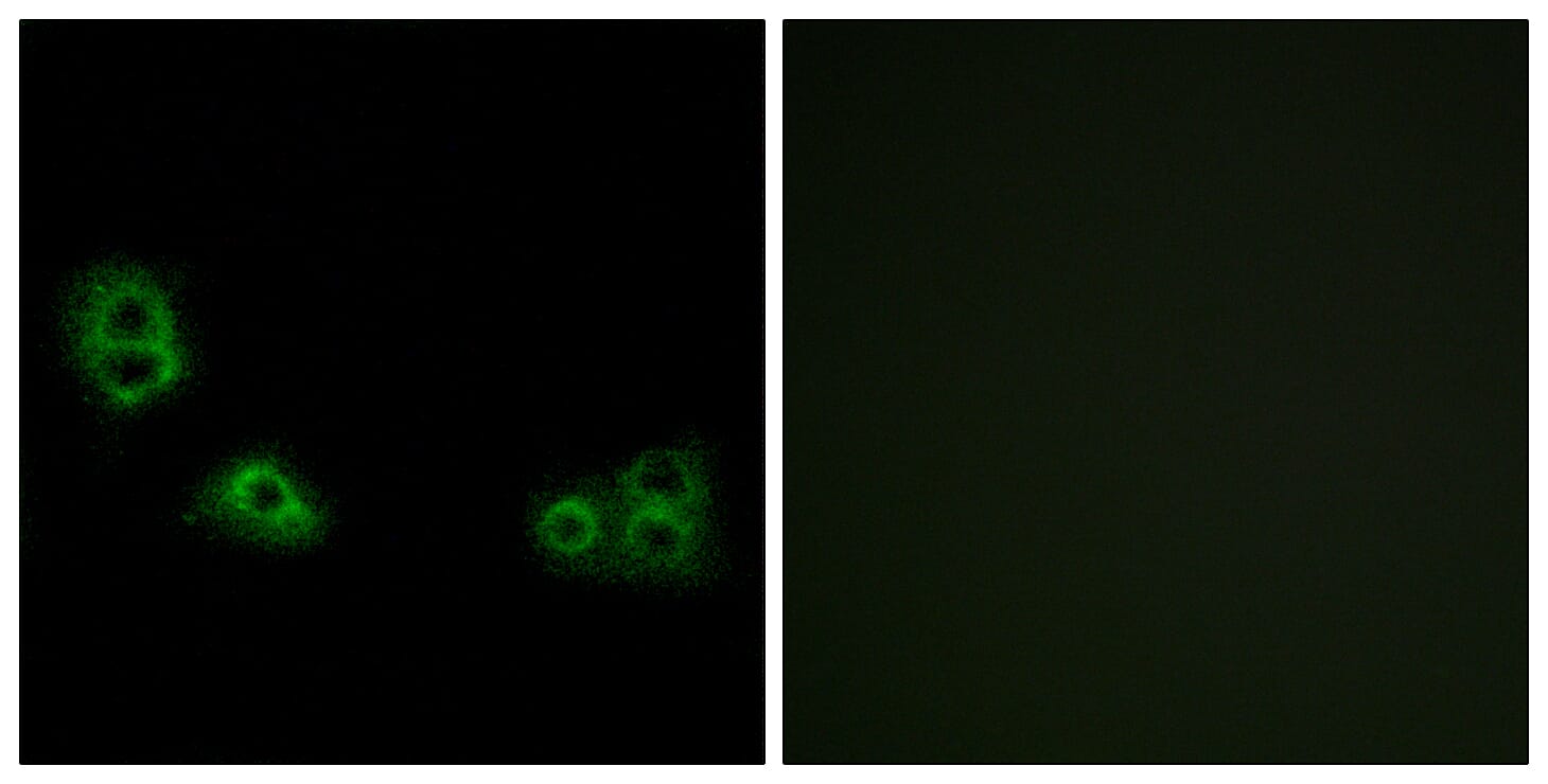 Immunofluorescence analysis of MCF7 cells using Anti-TMEM185A Antibody. The right hand panel represents a negative control, where the antibody was pre-incubated with the immunising peptide.
