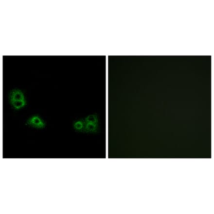 Immunofluorescence - Anti-TMEM185A Antibody (G749) - Antibodies.com