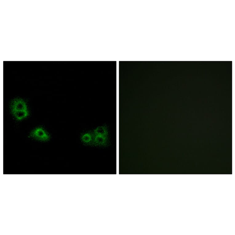 Immunofluorescence - Anti-TMEM185A Antibody (G749) - Antibodies.com