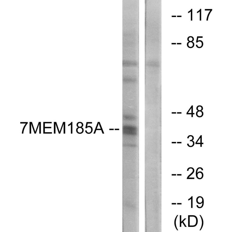 Western Blot - Anti-TMEM185A Antibody (G749) - Antibodies.com