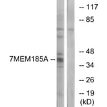 Western Blot - Anti-TMEM185A Antibody (G749) - Antibodies.com