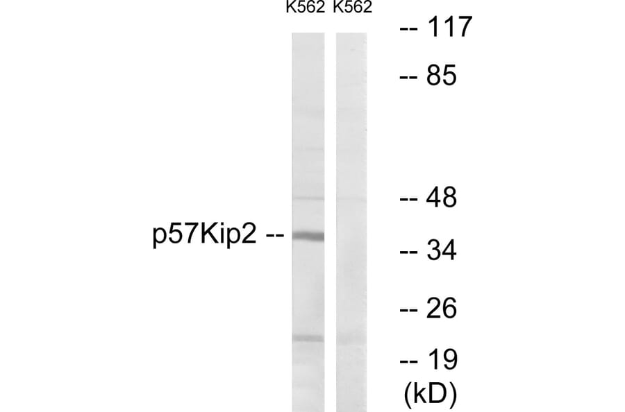 Western Blot - Anti-p57 Kip2 Antibody (B0967) - Antibodies.com