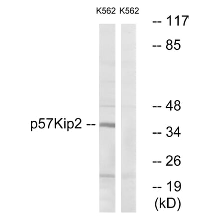 Western Blot - Anti-p57 Kip2 Antibody (B0967) - Antibodies.com